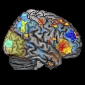 image showing activation from all three imaging methods